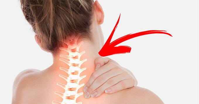 Sakit sa leeg kung bakit at kung ano ang gagawin